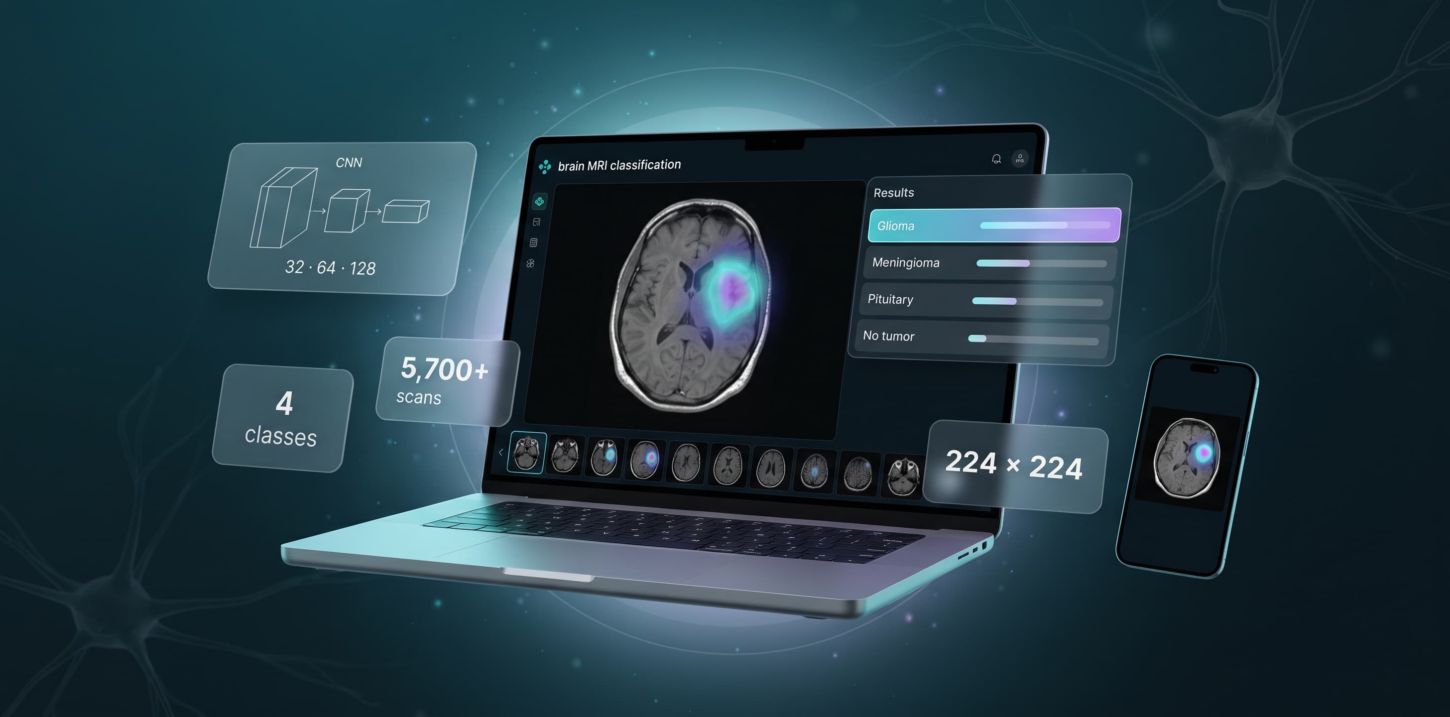 Brain Tumor MRI — CNN